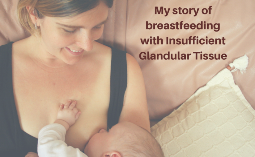 My story of breastfeeding with Insufficent Glandular Tissue